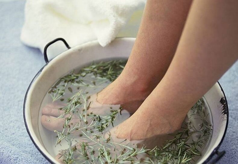 Vonia su žolelių nuoviru nuo kojų nagų grybelio