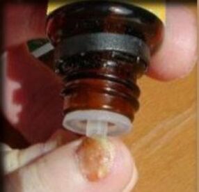 Lašelių tepimas ant grybelio pažeisto kojų nago